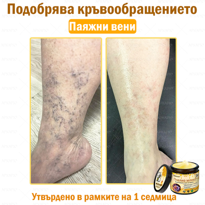 ✨💜💜APKAPK® КРЕМ ЗА ДЪЛБОКО ПОДХРАНВАНЕ НА КОЖАТА 🥇 Обхваща лечението на кожни проблеми като: бръчки, белези, петна, кожни израстъци, мазнини, пъпки, екзема, псориазис, акне и инверсни лезии, рани, кожни раздразнения и други проблеми 🔥