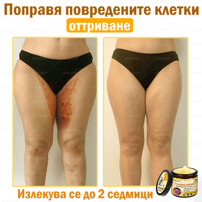 ✨💜💜APKAPK® КРЕМ ЗА ДЪЛБОКО ПОДХРАНВАНЕ НА КОЖАТА 🥇 Обхваща лечението на кожни проблеми като: бръчки, белези, петна, кожни израстъци, мазнини, пъпки, екзема, псориазис, акне и инверсни лезии, рани, кожни раздразнения и други проблеми 🔥