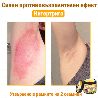 ✨💜💜APKAPK® КРЕМ ЗА ДЪЛБОКО ПОДХРАНВАНЕ НА КОЖАТА 🥇 Обхваща лечението на кожни проблеми като: бръчки, белези, петна, кожни израстъци, мазнини, пъпки, екзема, псориазис, акне и инверсни лезии, рани, кожни раздразнения и други проблеми 🔥