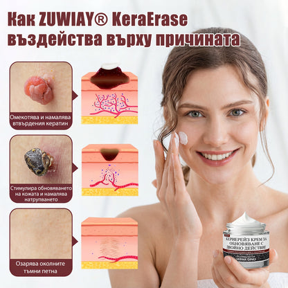 Клинично доказано решение против брадавици👨‍⚕️ZUWIAY® KeraErase Двойно Действие Подмладяващ Крем🔥 Безболезнено и мощно премахва: обикновени брадавици, плантарни брадавици, плоски брадавици, нишковидни брадавици и папиломи.