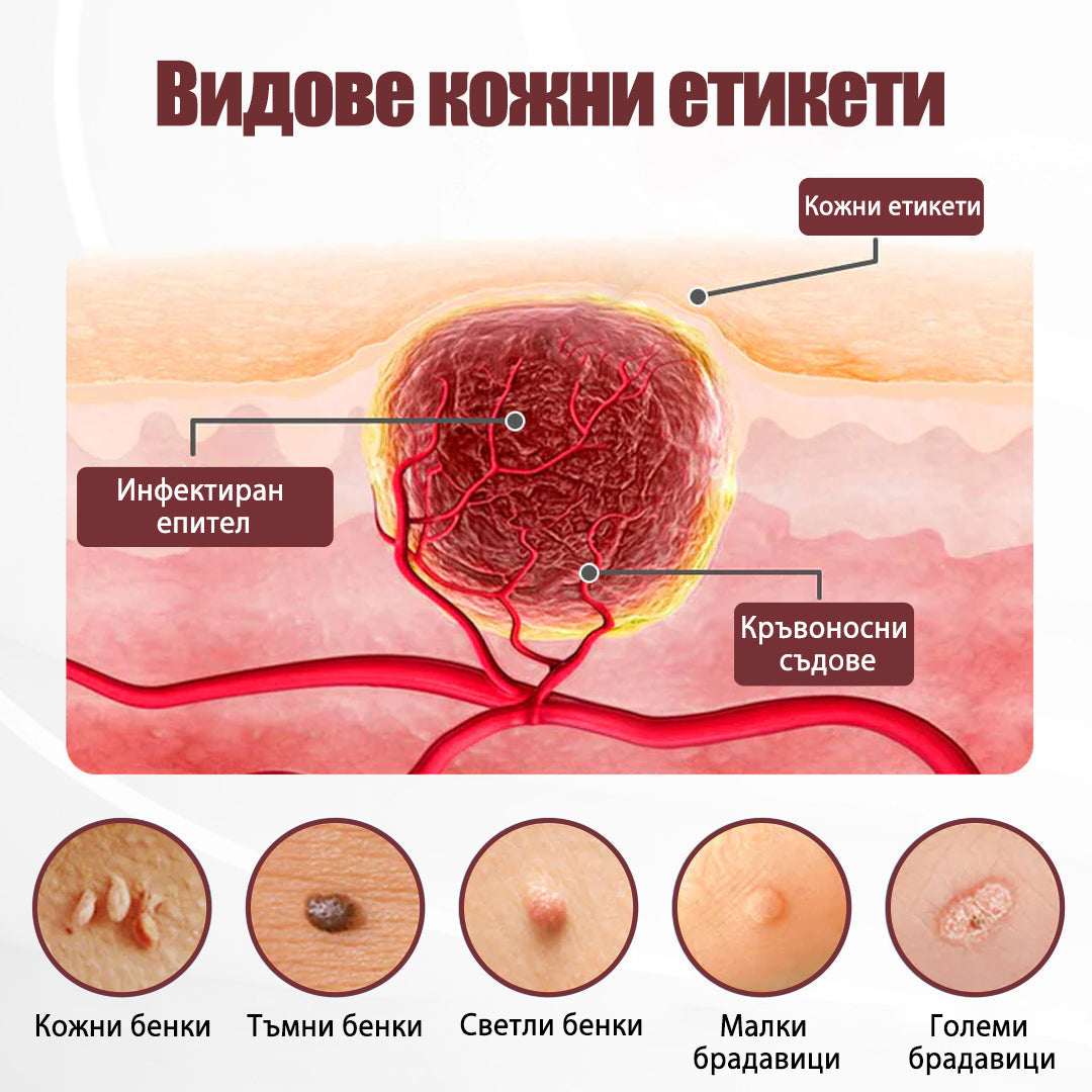 Клинично доказано решение против брадавици👨‍⚕️ZUWIAY® KeraErase Двойно Действие Подмладяващ Крем🔥 Безболезнено и мощно премахва: обикновени брадавици, плантарни брадавици, плоски брадавици, нишковидни брадавици и папиломи.