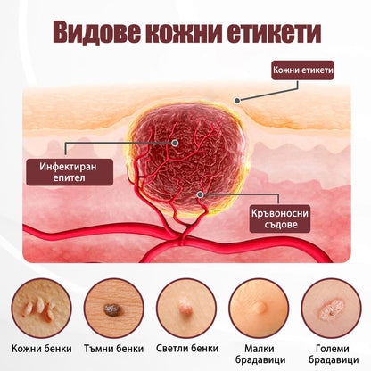 Клинично доказано решение против брадавици👨‍⚕️ZUWIAY® KeraErase Двойно Действие Подмладяващ Крем🔥 Безболезнено и мощно премахва: обикновени брадавици, плантарни брадавици, плоски брадавици, нишковидни брадавици и папиломи.