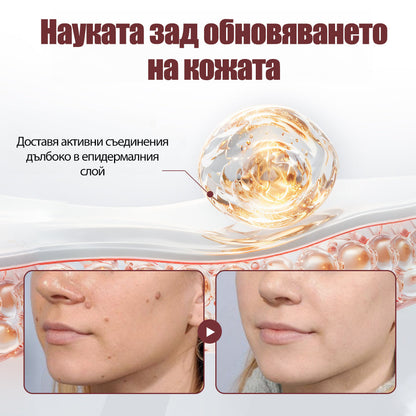 Клинично доказано решение против брадавици👨‍⚕️ZUWIAY® KeraErase Двойно Действие Подмладяващ Крем🔥 Безболезнено и мощно премахва: обикновени брадавици, плантарни брадавици, плоски брадавици, нишковидни брадавици и папиломи.