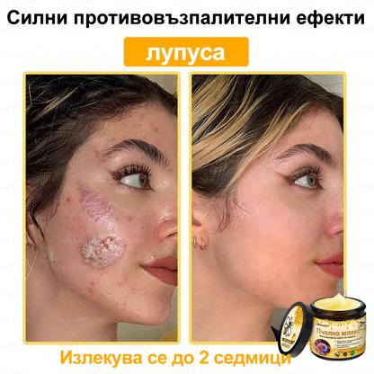 ✨💜💜APKAPK® КРЕМ ЗА ДЪЛБОКО ПОДХРАНВАНЕ НА КОЖАТА 🥇 Обхваща лечението на кожни проблеми като: бръчки, белези, петна, кожни израстъци, мазнини, пъпки, екзема, псориазис, акне и инверсни лезии, рани, кожни раздразнения и други проблеми 🔥