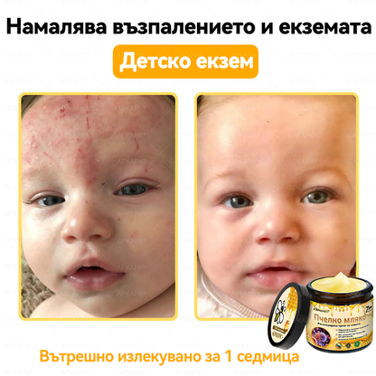 ✨💜💜APKAPK® КРЕМ ЗА ДЪЛБОКО ПОДХРАНВАНЕ НА КОЖАТА 🥇 Обхваща лечението на кожни проблеми като: бръчки, белези, петна, кожни израстъци, мазнини, пъпки, екзема, псориазис, акне и инверсни лезии, рани, кожни раздразнения и други проблеми 🔥