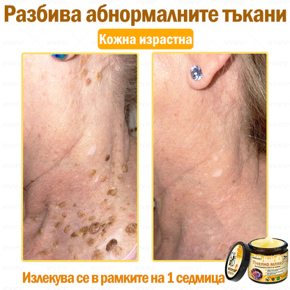 ✨💜💜APKAPK® КРЕМ ЗА ДЪЛБОКО ПОДХРАНВАНЕ НА КОЖАТА 🥇 Обхваща лечението на кожни проблеми като: бръчки, белези, петна, кожни израстъци, мазнини, пъпки, екзема, псориазис, акне и инверсни лезии, рани, кожни раздразнения и други проблеми 🔥