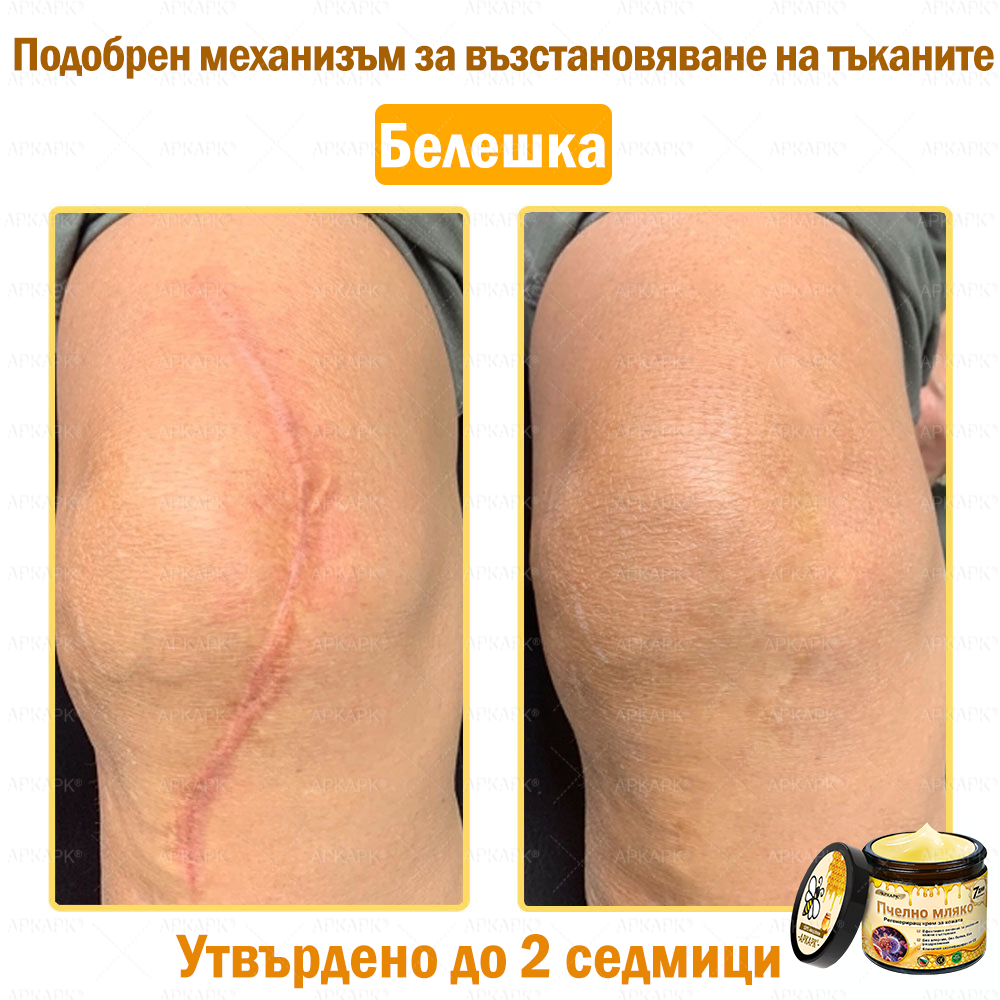 ✨💜💜APKAPK® КРЕМ ЗА ДЪЛБОКО ПОДХРАНВАНЕ НА КОЖАТА 🥇 Обхваща лечението на кожни проблеми като: бръчки, белези, петна, кожни израстъци, мазнини, пъпки, екзема, псориазис, акне и инверсни лезии, рани, кожни раздразнения и други проблеми 🔥