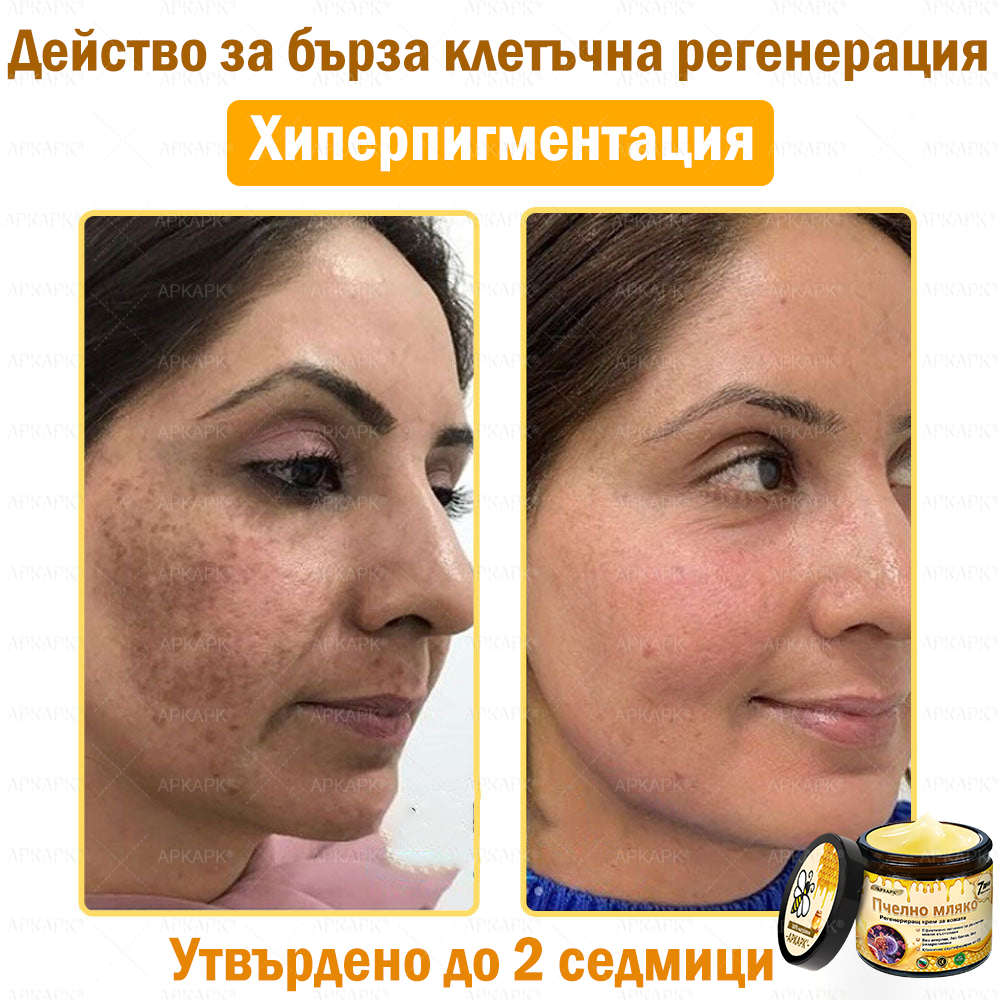 ✨💜💜APKAPK® КРЕМ ЗА ДЪЛБОКО ПОДХРАНВАНЕ НА КОЖАТА 🥇 Обхваща лечението на кожни проблеми като: бръчки, белези, петна, кожни израстъци, мазнини, пъпки, екзема, псориазис, акне и инверсни лезии, рани, кожни раздразнения и други проблеми 🔥