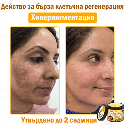 ✨💜💜APKAPK® КРЕМ ЗА ДЪЛБОКО ПОДХРАНВАНЕ НА КОЖАТА 🥇 Обхваща лечението на кожни проблеми като: бръчки, белези, петна, кожни израстъци, мазнини, пъпки, екзема, псориазис, акне и инверсни лезии, рани, кожни раздразнения и други проблеми 🔥